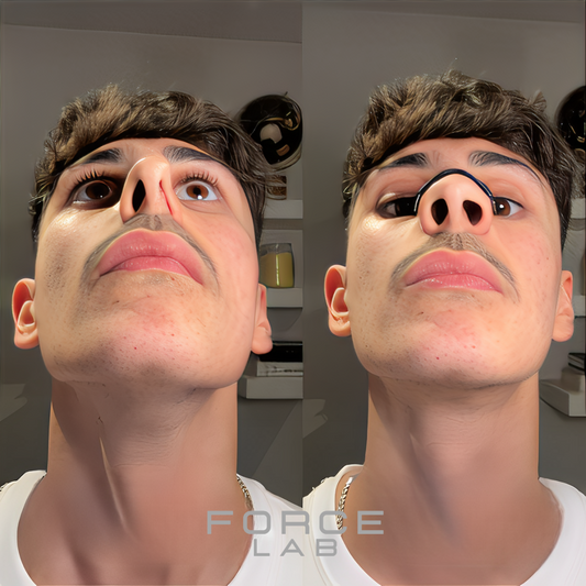 ForceLab™ V2 Tiras nasales magnéticas (15 días)